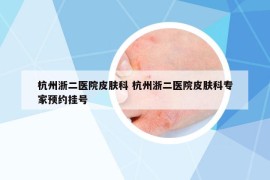 杭州浙二医院皮肤科 杭州浙二医院皮肤科专家预约挂号