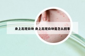 身上出现白块 身上出现白块是怎么回事