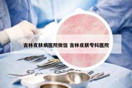 吉林皮肤病医院微信 吉林皮肤专科医院