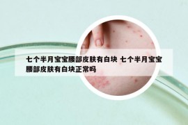 七个半月宝宝腰部皮肤有白块 七个半月宝宝腰部皮肤有白块正常吗