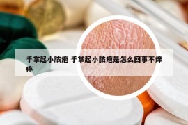 手掌起小脓疱 手掌起小脓疱是怎么回事不痒疼