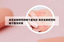 南京皮肤研究院哪个医生好 南京皮肤研究院哪个医生好些