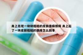 身上出现一块块粗糙的皮肤像癣很痒 身上起了一块皮肤粗糙的很痒怎么回事