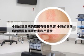 小孩的银屑病的原因有哪些危害 小孩的银屑病的原因有哪些危害和严重性