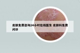 皮肤免费咨询24小时在线医生 皮肤科免费问诊