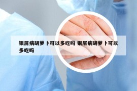 银屑病胡萝卜可以多吃吗 银屑病胡萝卜可以多吃吗