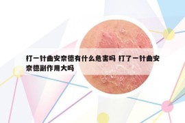 打一针曲安奈德有什么危害吗 打了一针曲安奈德副作用大吗