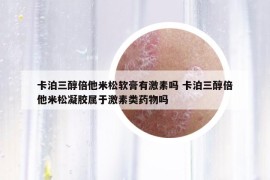 卡泊三醇倍他米松软膏有激素吗 卡泊三醇倍他米松凝胶属于激素类药物吗