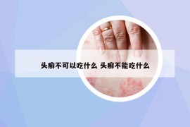头癣不可以吃什么 头癣不能吃什么