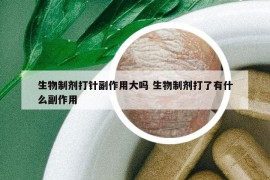 生物制剂打针副作用大吗 生物制剂打了有什么副作用