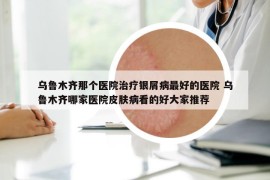 乌鲁木齐那个医院治疗银屑病最好的医院 乌鲁木齐哪家医院皮肤病看的好大家推荐