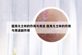 医用凡士林的作用与用途 医用凡士林的作用与用途副作用