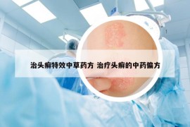 治头癣特效中草药方 治疗头癣的中药偏方