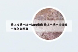 脸上皮肤一块一块的像癣 脸上一块一块像癣一样怎么回事