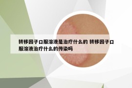 转移因子口服溶液是治疗什么的 转移因子口服溶液治疗什么的传染吗