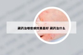 藏药治哪些病效果最好 藏药治什么
