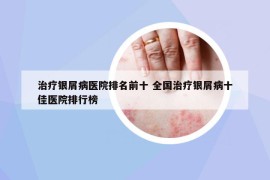 治疗银屑病医院排名前十 全国治疗银屑病十佳医院排行榜