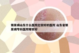 银屑病山东什么医院比较好的医院 山东省银屑病专科医院哪家好