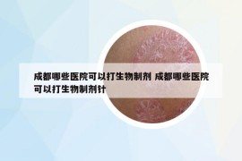 成都哪些医院可以打生物制剂 成都哪些医院可以打生物制剂针