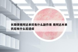 长期使用阿达单抗有什么副作用 用阿达木单抗后有什么后遗症