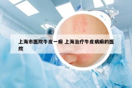 上海市医院牛皮一癣 上海治疗牛皮病癣的医院
