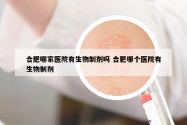 合肥哪家医院有生物制剂吗 合肥哪个医院有生物制剂