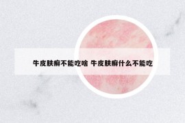 牛皮肤癣不能吃啥 牛皮肤癣什么不能吃