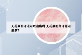 无花果的汁液可以治癣吗 无花果的白汁能治癣病?