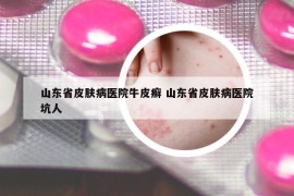 山东省皮肤病医院牛皮癣 山东省皮肤病医院坑人