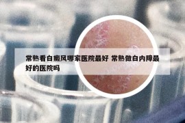 常熟看白癜风哪家医院最好 常熟做白内障最好的医院吗