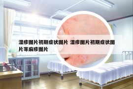 湿疹图片初期症状图片 湿疹图片初期症状图片荨麻疹图片