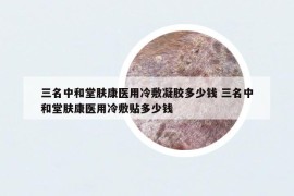 三名中和堂肤康医用冷敷凝胶多少钱 三名中和堂肤康医用冷敷贴多少钱