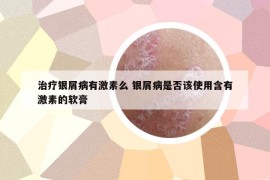 治疗银屑病有激素么 银屑病是否该使用含有激素的软膏