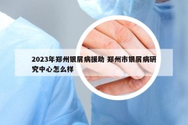 2023年郑州银屑病援助 郑州市银屑病研究中心怎么样