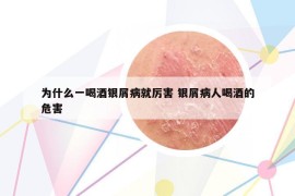 为什么一喝酒银屑病就厉害 银屑病人喝酒的危害