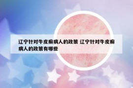 辽宁针对牛皮癣病人的政策 辽宁针对牛皮癣病人的政策有哪些
