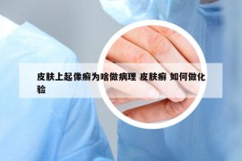 皮肤上起像癣为啥做病理 皮肤癣 如何做化验