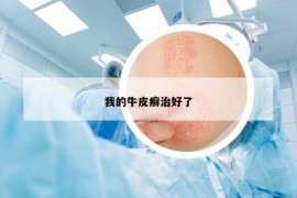 我的牛皮癣治好了