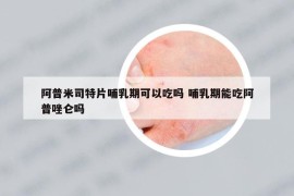 阿普米司特片哺乳期可以吃吗 哺乳期能吃阿普唑仑吗