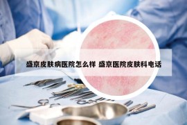 盛京皮肤病医院怎么样 盛京医院皮肤科电话