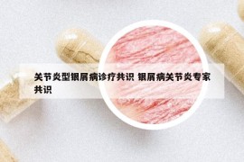 关节炎型银屑病诊疗共识 银屑病关节炎专家共识