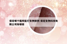 保定哪个医院能打生物制剂 保定生物科技有限公司有哪些