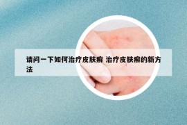 请问一下如何治疗皮肤癣 治疗皮肤癣的新方法