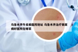 乌鲁木齐牛皮癣医院地址 乌鲁木齐治疗银屑病好医院在哪家