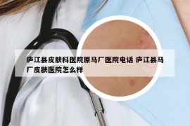 庐江县皮肤科医院原马厂医院电话 庐江县马厂皮肤医院怎么样