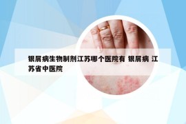 银屑病生物制剂江苏哪个医院有 银屑病 江苏省中医院