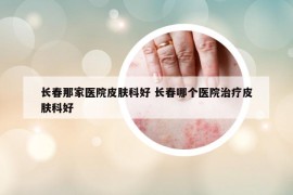 长春那家医院皮肤科好 长春哪个医院治疗皮肤科好