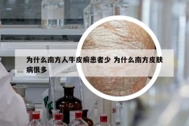 为什么南方人牛皮癣患者少 为什么南方皮肤病很多