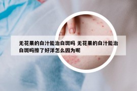 无花果的白汁能治白斑吗 无花果的白汁能治白斑吗擦了好洋怎么因为呢