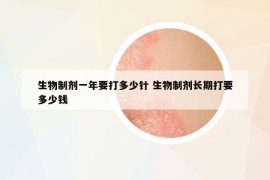 生物制剂一年要打多少针 生物制剂长期打要多少钱